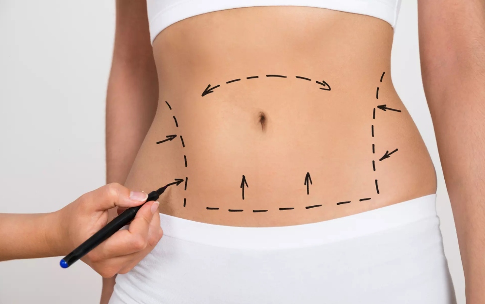 Principais razões para considerar Lisboa para o seu procedimento de lipoaspiração